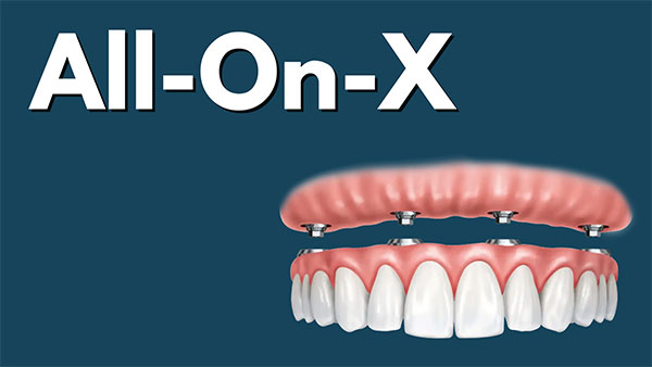 Eastern Pines Dental | Botox reg  Treatments for Jaw Pain, Dental Implants and Oral Surgery